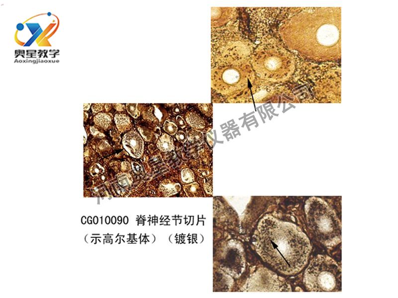 脊神經(jīng)節(jié)切片