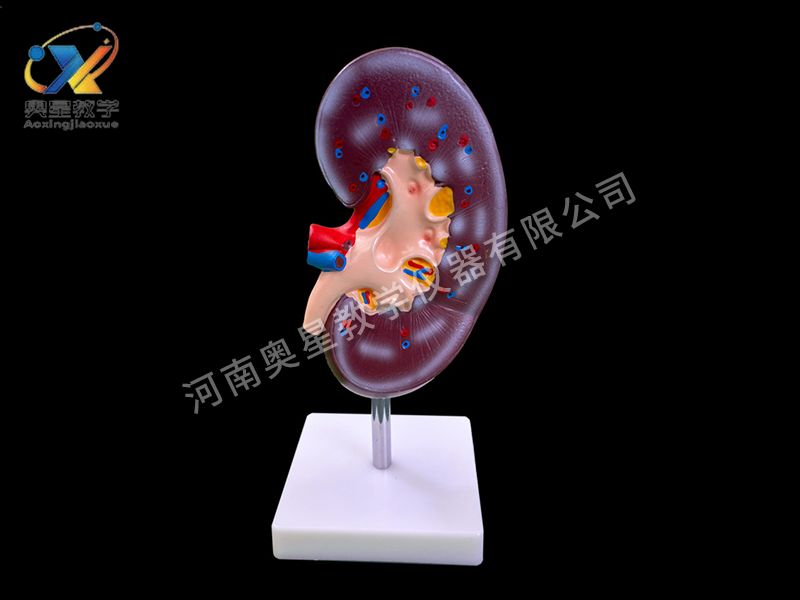 腎解剖模型
